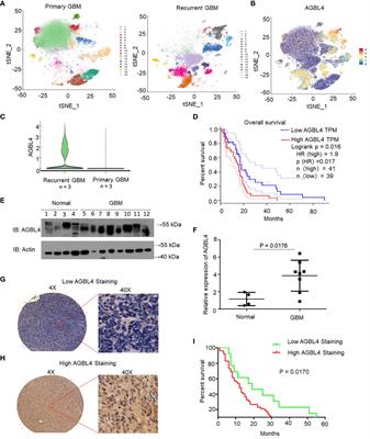 AGBL4 promotes malignant progression of glioblastoma via modulation of MMP-1 and inflammatory pathways